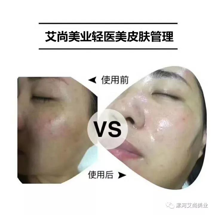 【艾尚美业】——第三期皮肤管理课程火热报名(图4)